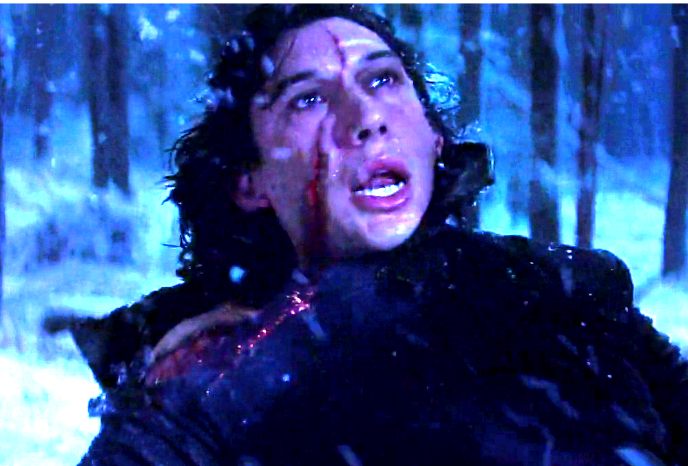 La cicatrice di Kylo in Episodio VII.Da: star wars forum