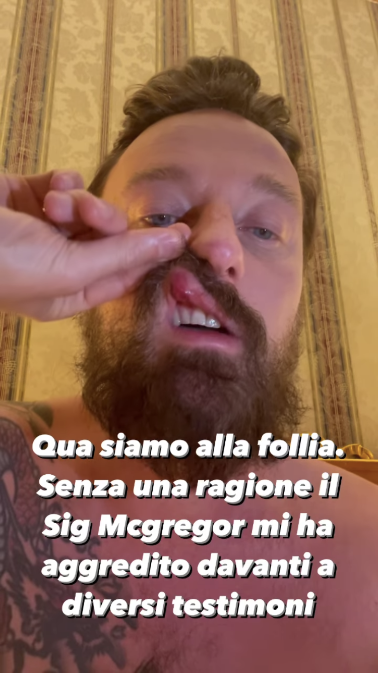 La storia di Francesco Facchinetti su Instagram
