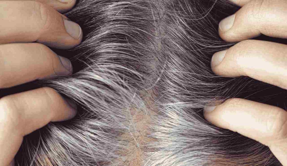 Stop ai capelli grigi: un antiossidante nel sedano e nei broccoli potrebbe essere la chiave - Un antiossidante contribuisce a ridurre la comparsa dei capelli grigi (canva.com) - www.notiziesecche.it