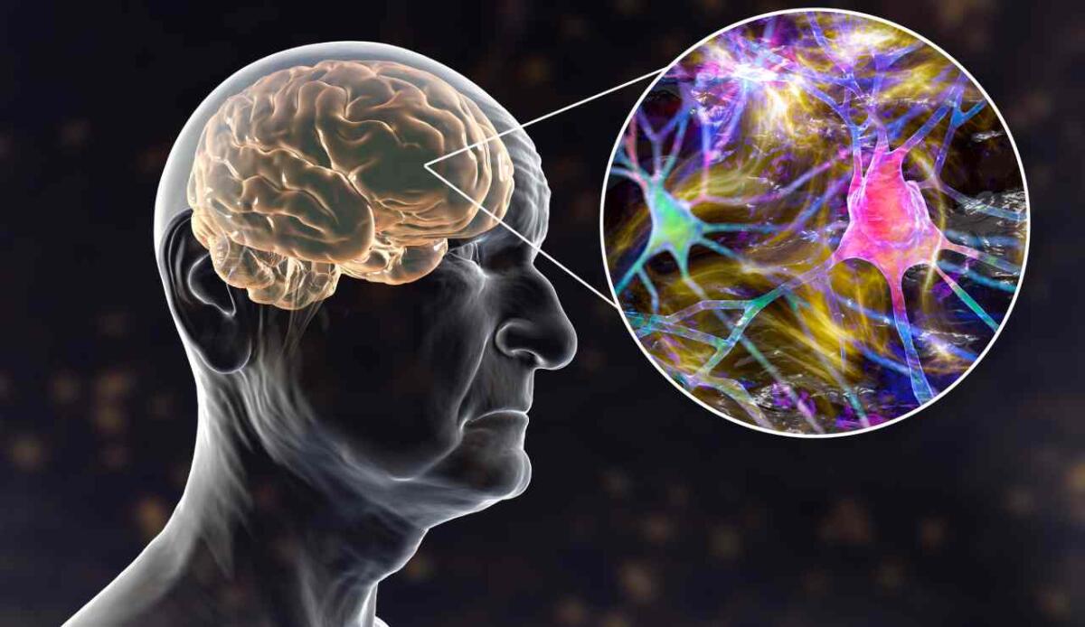Quanto invecchia il tuo cervello? Un’AI lo misura con scansioni cerebrali - Malattie del cervello, ecco l'IA che può prevenirle (DepositPhotos) - FindBest