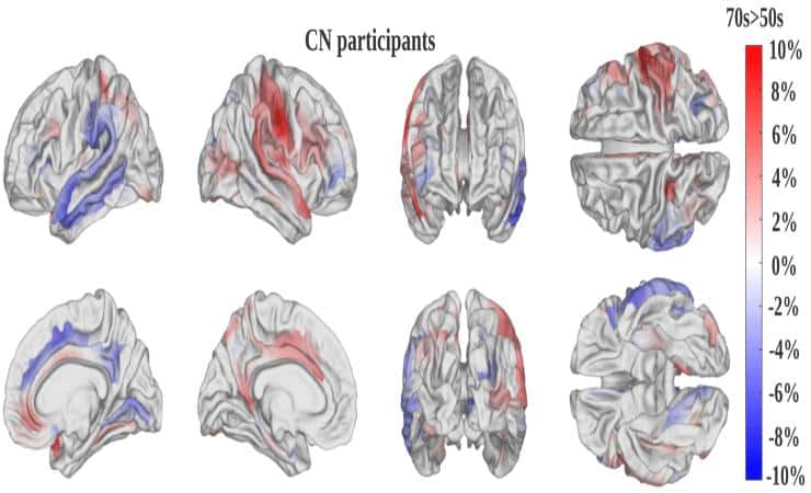 IA, ecco quella per calcolare l'età del cervello (Gero.esc.edu) - FindBest