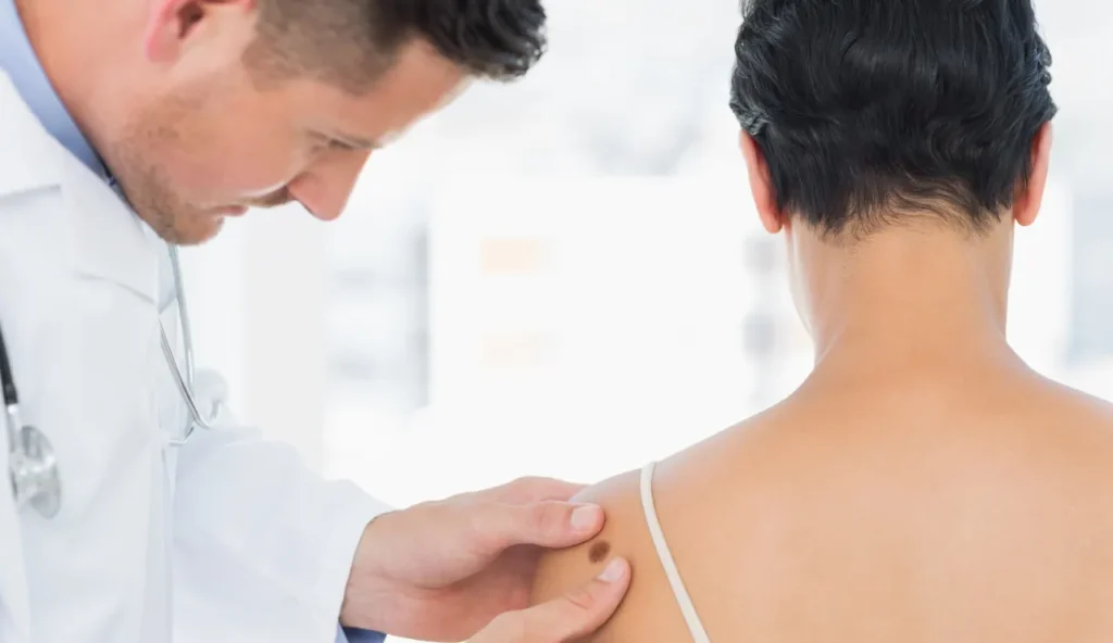 Un virus rivoluzionario potrebbe combattere il melanoma avanzato