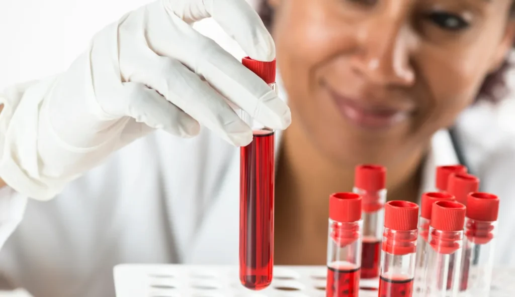 Nuovo test del sangue distingue tra Alzheimer, Parkinson e demenze con un solo esame