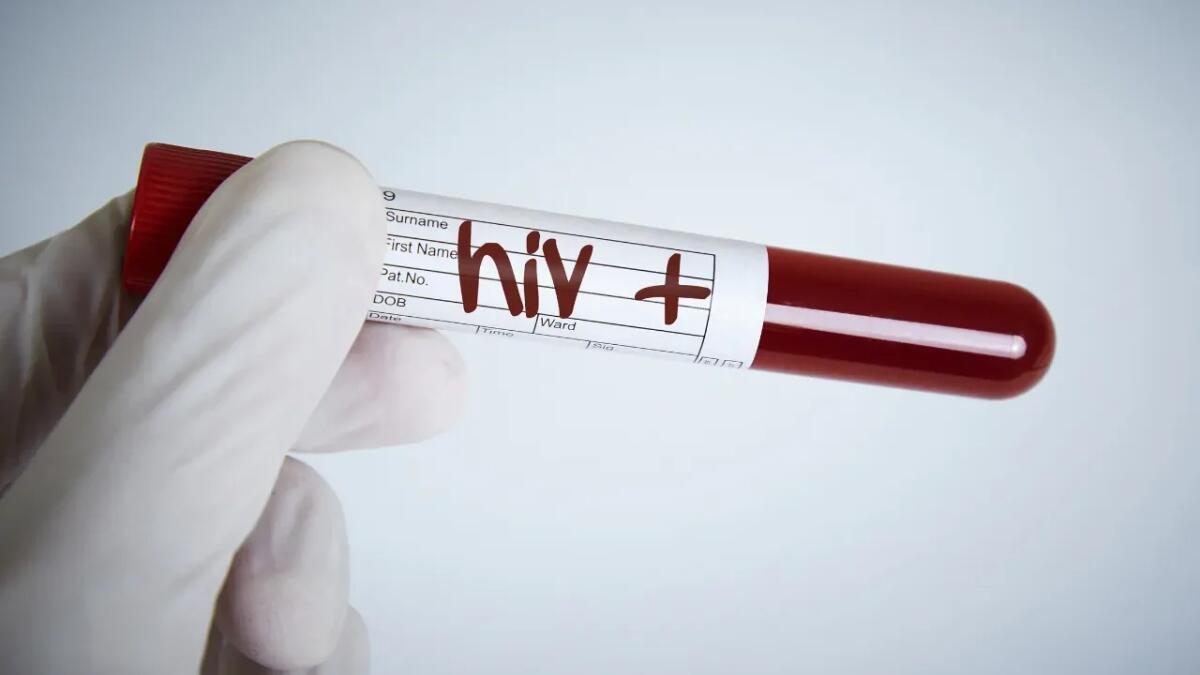 Perché alcuni neonati negli Stati Uniti contraggono ancora l'HIV nonostante gli screening? - 