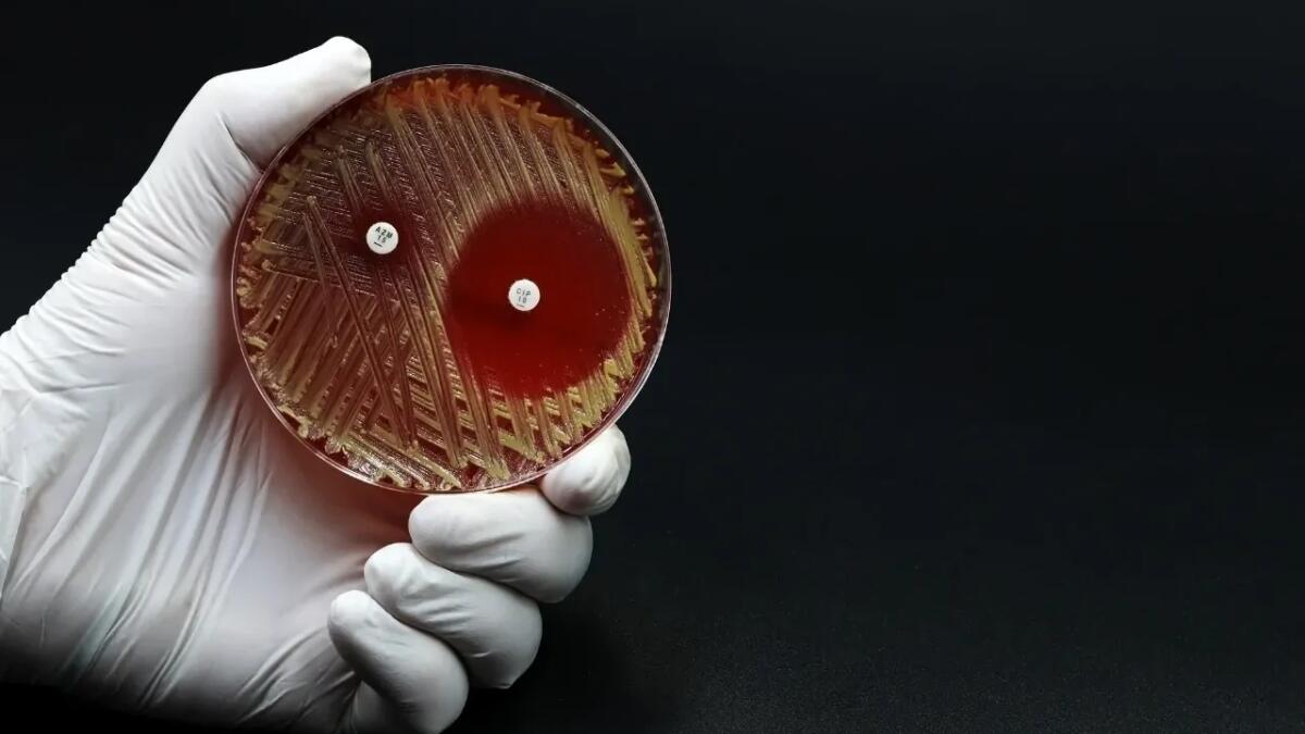 Allarme antibiotico-resistenza: batteri pericolosi trovati in volatili selvatici in Brasile - 